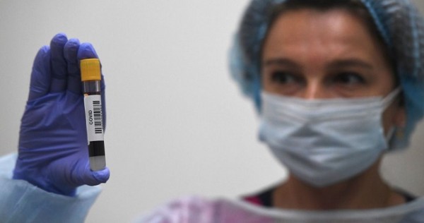 В Узбекистане разработали тест-систему для выявления РНК коронавируса