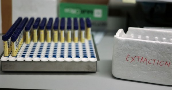 В СНГ упростят поставки медицинских изделий для борьбы с COVID-19