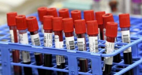 В Таджикистане за выходные зарегистрировано 124 случаев инфицирования коронавирусом