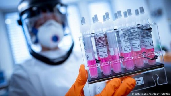 За сутки зарегистрировано 72 новых случая инфицирования и 1 смерть от коронавируса
