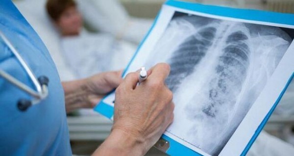 За минувшие выходные выявлено 138 случаев инфицирования коронавирусом