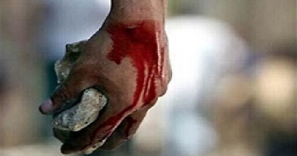 Житель Ашта подозревается в причинении тяжкого вреда здоровью