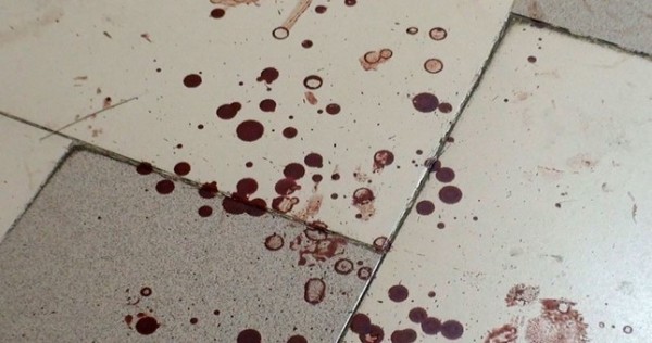 В Москве гражданин Таджикистана пытался убить себя, вонзив гвоздь в сердце