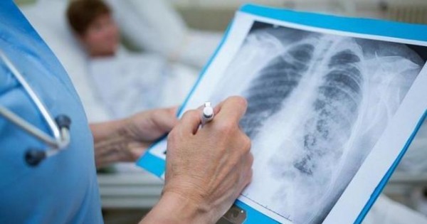 В Таджикистане выявлен 41 новый случай инфицирования COVID-19
