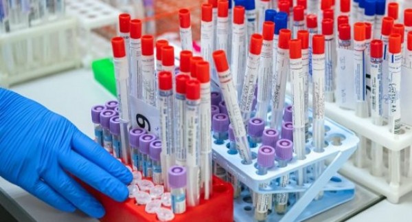 В Таджикистане выявлено 39 новых случаев инфицирования COVID-19