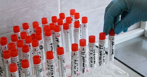 За истекшие сутки в Таджикистане зарегистрировано 50 новых случаев инфицирования COVID-19