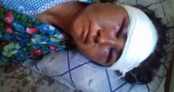 В Узбекистане жена попала в реанимацию из-за побоев мужа сразу после свадьбы