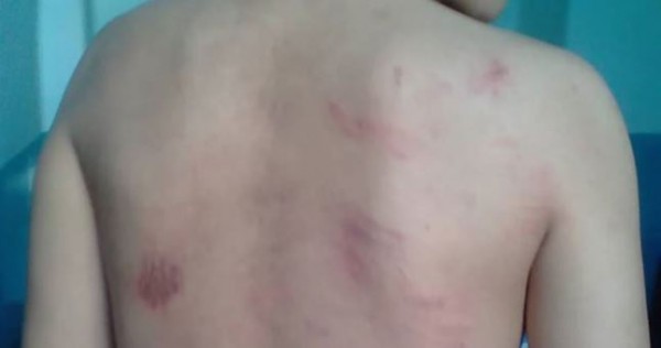 "Моего сына пытали электрическим током"