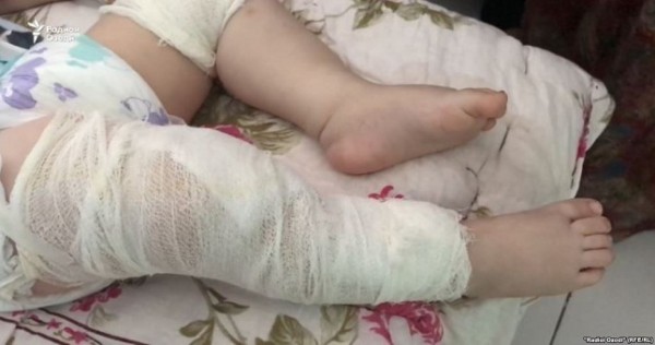 В Таджикистане женщина отрицает, что втыкала в тело своего малыша иглы