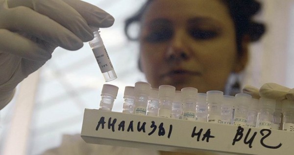В ГБАО отмечается ежегодный прирост ВИЧ-инфицированных