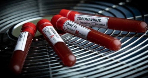 Коронавирус провоцирует развитие других заболеваний, - исследование