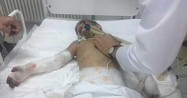В Ингушетии семилетняя девочка едва не погибла от истязаний в семье