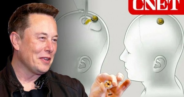 Маск: Первый человек с мозговым имплантом от Neuralink смог управлять компьютерной мышью с помощью мыслей